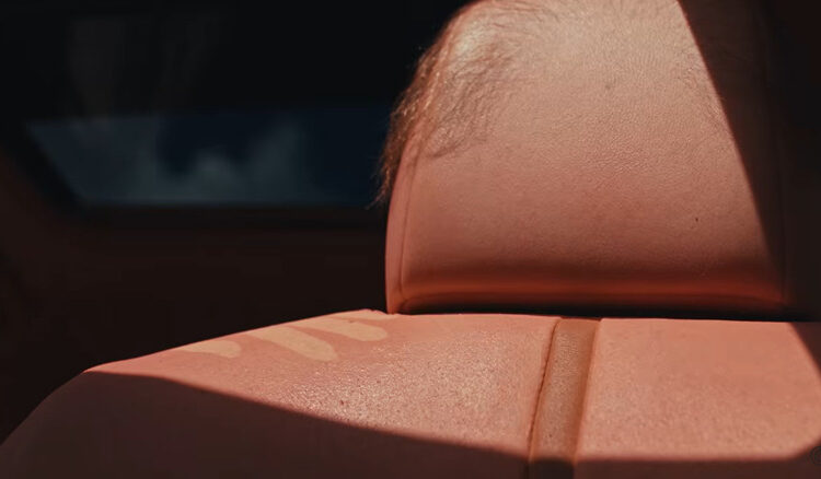 Australian Company Sheds Light On In-Car Sun Exposure By Reupholstering A Camry With Human-Like Skin That ‘Burns’ In Sunlight